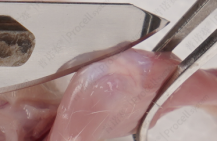 暴露出关节腔组织处理