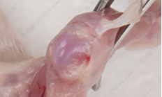 暴露出关节腔组织处理