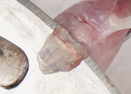 使用手术刀切下关节软骨组织