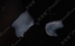 清理后的关节软骨组织