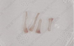 冲至骨头发白透亮