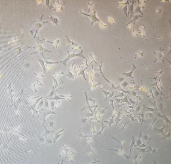 B16-F10细胞支原体污染形态（客户反馈实例）