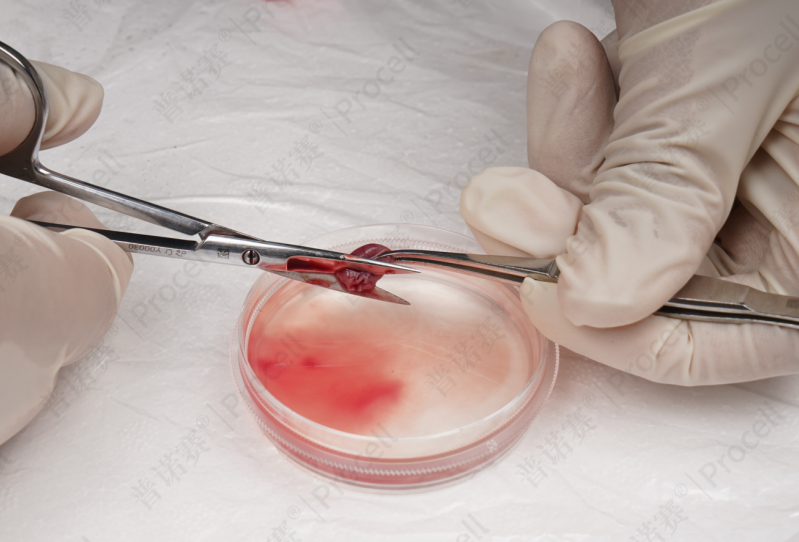 剪开心脏组织上方的血管