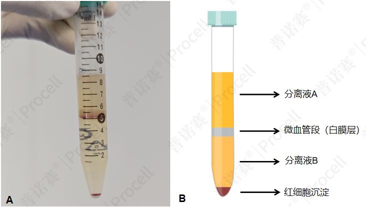 细胞经分离液纯化后图