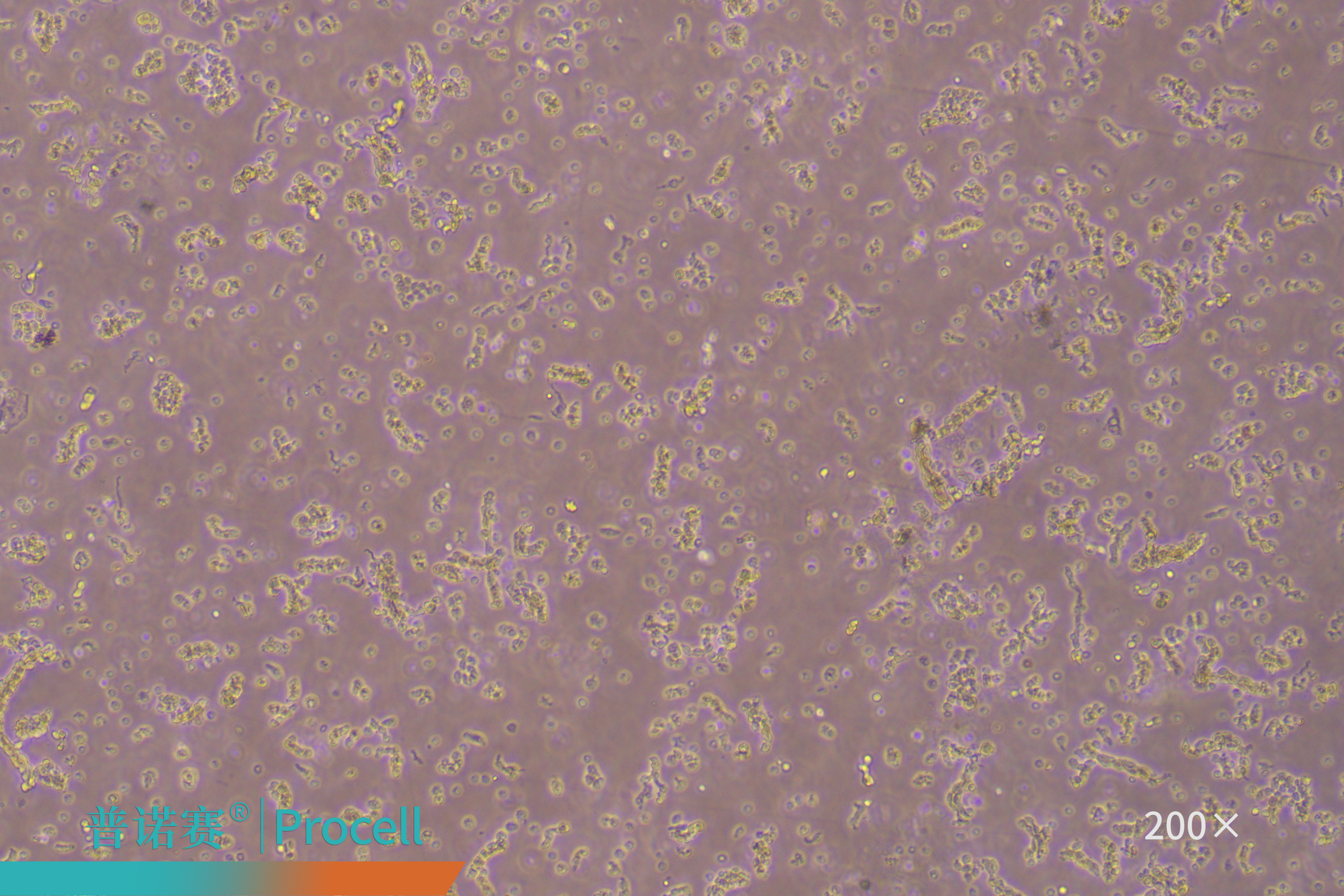 刚接种后的细胞悬液,可见明显的微血管段组织