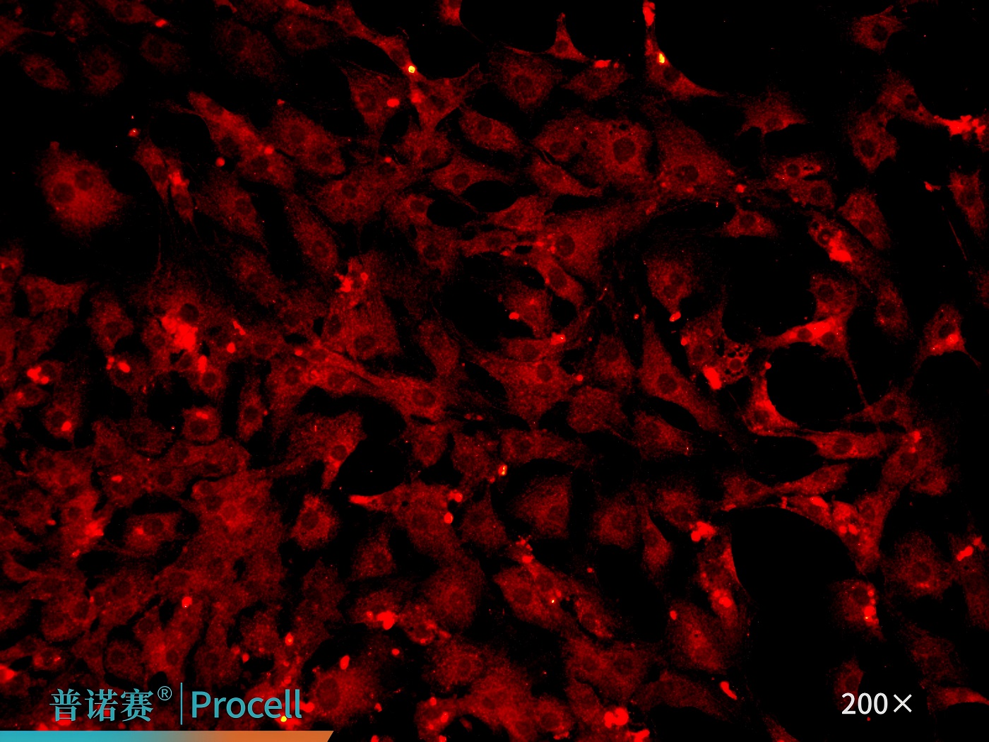 DAPI 免疫荧光染色检测内皮细胞特异性标志物CD31