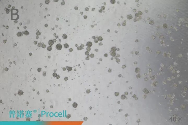 肿瘤干细胞成球（A：HCT 116