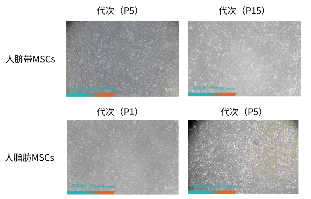 人脐带MSCs、人脂肪MSCs不同代次细胞观察