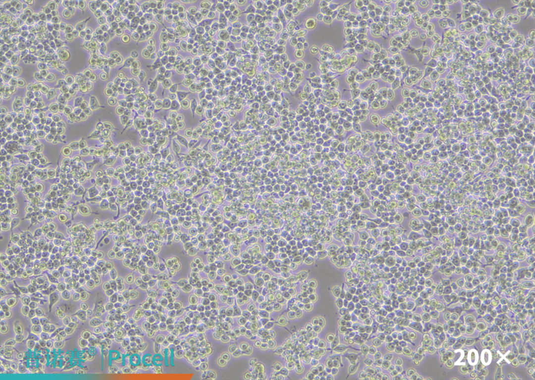 RAW 264.7细胞转染效率白光图片