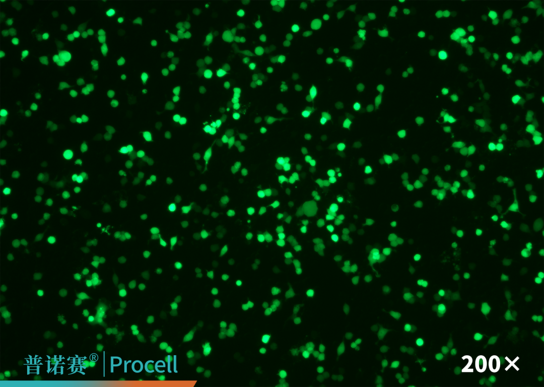RAW 264.7细胞转染效率荧光图片