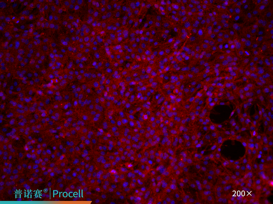 CD31免疫荧光鉴定Merge
