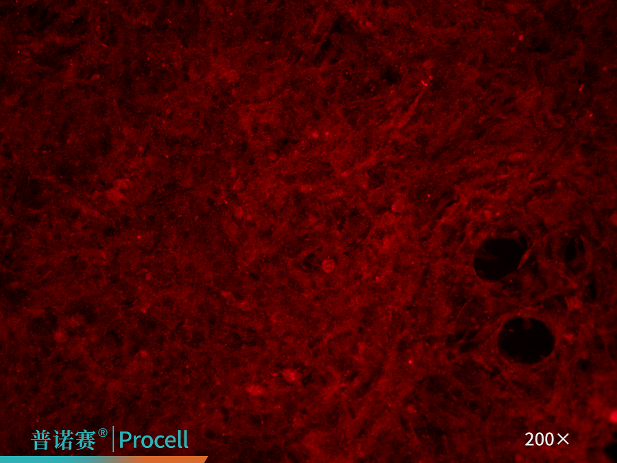 CD31免疫荧光鉴定DAPI