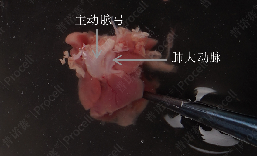 找到肺大动脉用显微直镊夹住