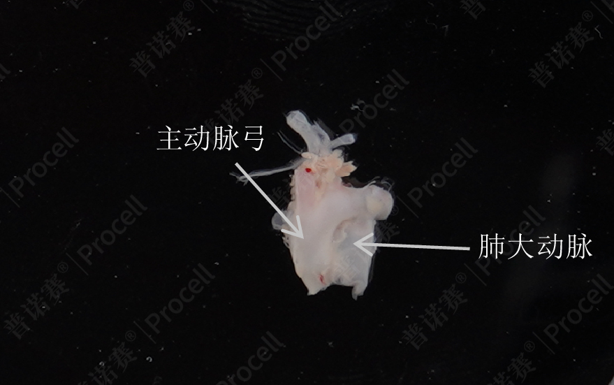 剪下的主动脉与肺大动脉