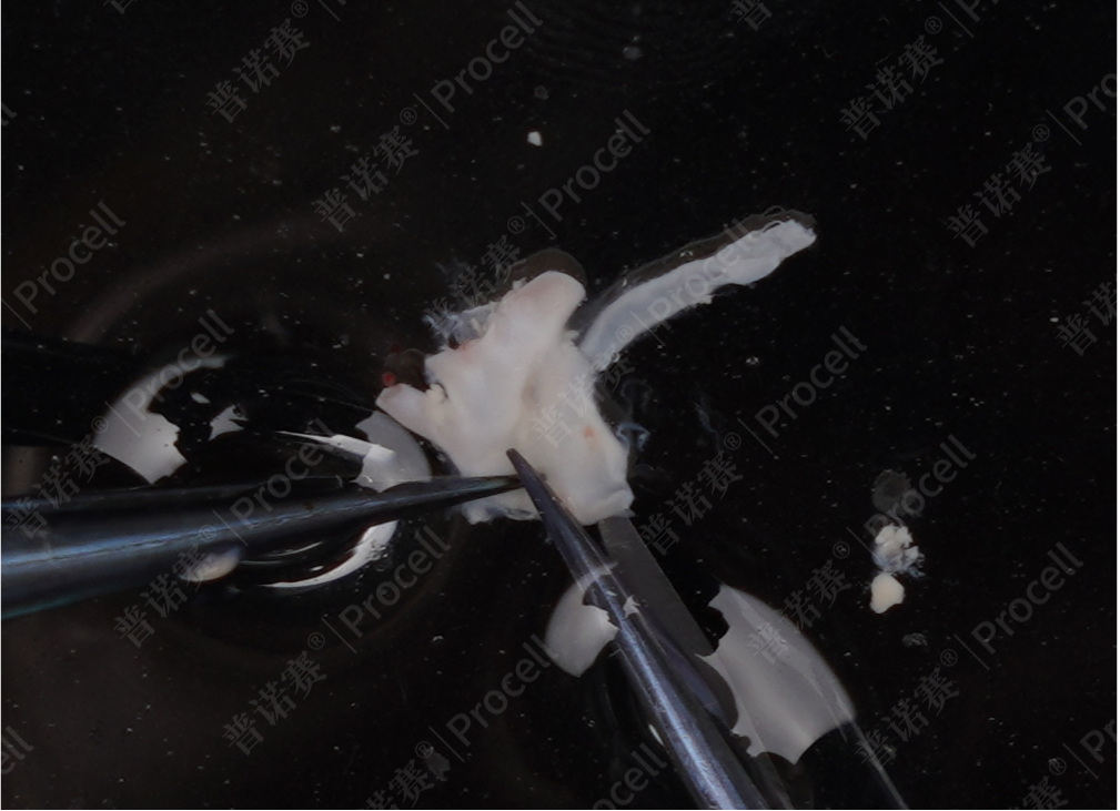 用显微剪将两根血管剪开