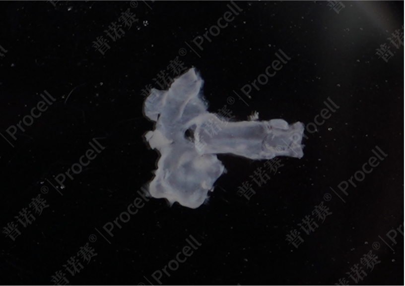 纵向剖开肺大动脉