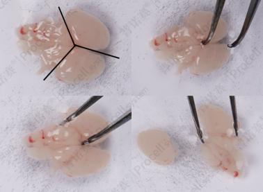 分离小脑与大脑