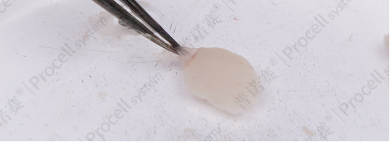 左手辅助固定脑组织,右手使用解剖镊撕下脑膜