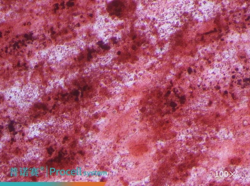 人骨髓间充质干细胞成骨分化鉴定结果