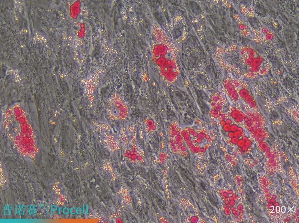 人骨髓间充质干细胞成脂分化鉴定结果