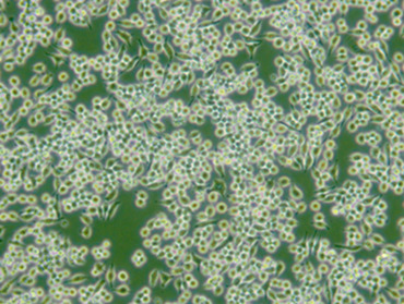 RAW264.7细胞生长图片