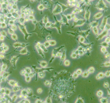 分化的RAW 264.7细胞形态