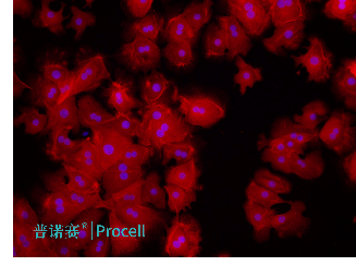 小鼠肝實(shí)質(zhì)細(xì)胞免疫熒光鑒定圖